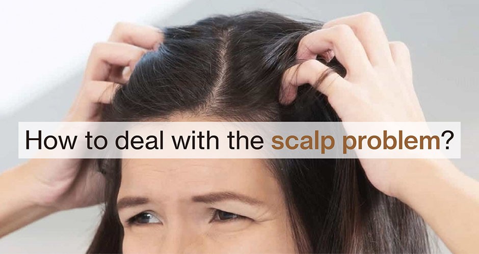 How to deal with the scalp problem?
